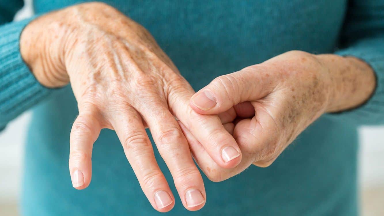 artritis reumatoide síntomas
