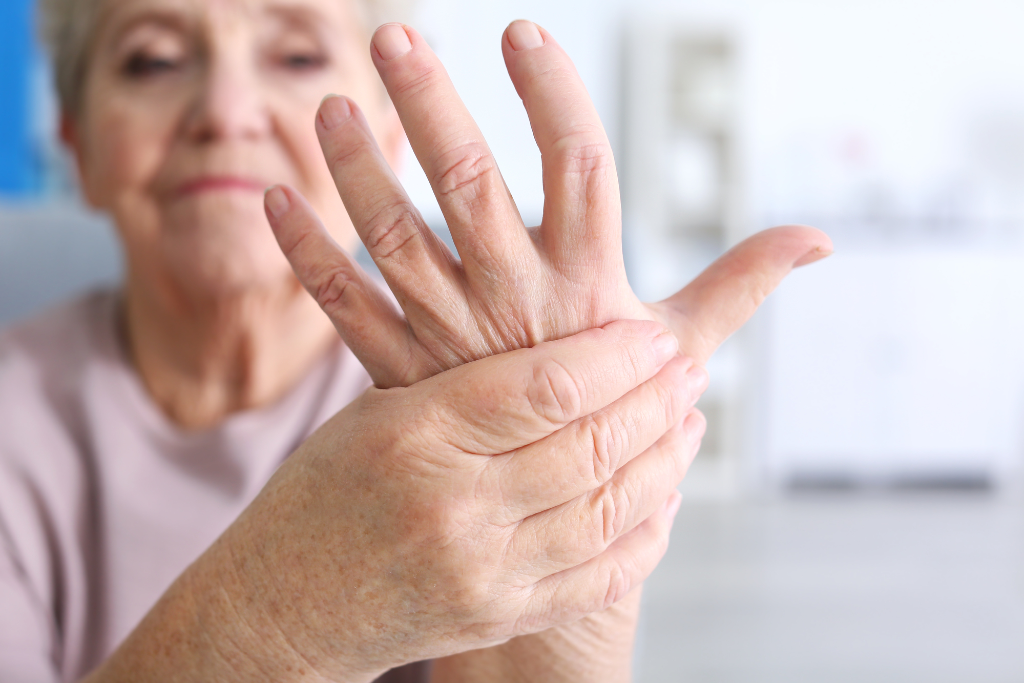 artritis reumatoide síntomas